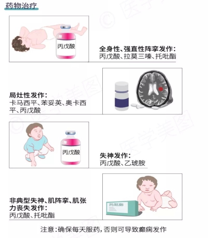  面對癲癇發(fā)作患者，該如何施以援手？ 