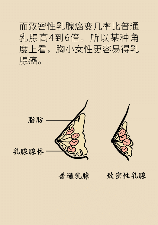 胸小就不會(huì)得乳腺癌嗎？醫(yī)生：患病概率更高