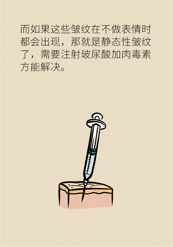 想要看起來更年輕？這些方法或可幫到你