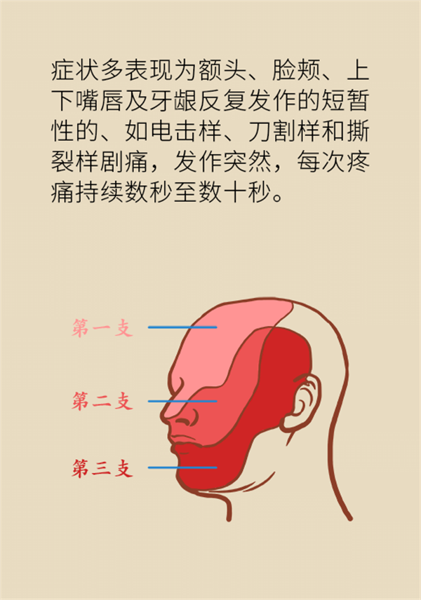 這種疼痛不是牙疼？緩解三叉神經(jīng)痛就用這兩招