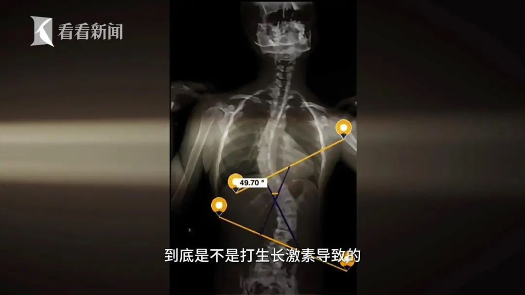焦慮的家長擅自給孩子打“增高針”，醫(yī)生：需專業(yè)評估否則存風(fēng)險