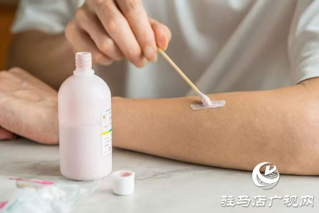 爐甘石洗劑并非“萬能神藥” 這些情況要慎用！