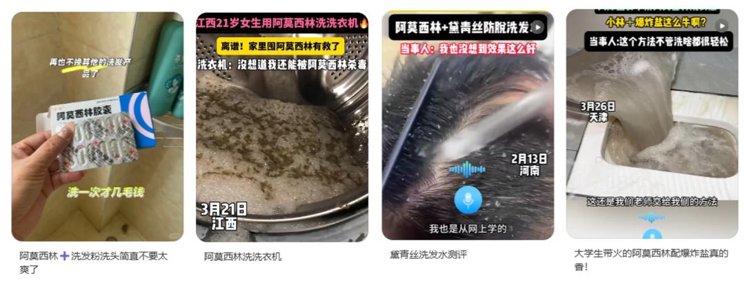 用阿莫西林洗頭，能治療脫發(fā)？別信！