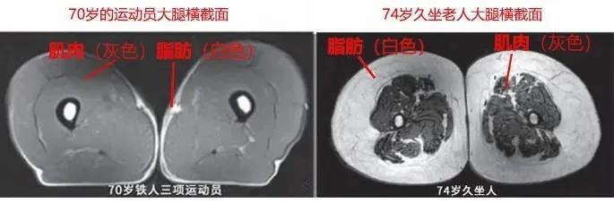 運(yùn)動(dòng)是加速衰老，還是延緩衰老？真相揭開